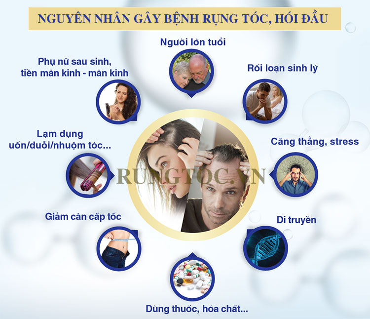 6 thuốc mọc tóc giúp bạn nhanh chóng lấy lại mái tóc đen dài - Dược sĩ Lưu  Văn Hoàng
