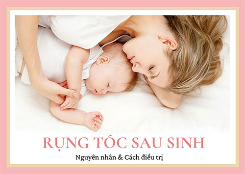 Nguyên nhân gây rụng tóc sau sinh và cách khắc phục