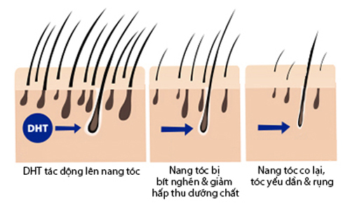 Tóc rụng nhiều bất thường phải làm sao?