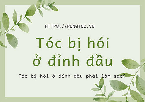 Tóc thưa tóc bị hói ở đỉnh đầu phải làm sao?