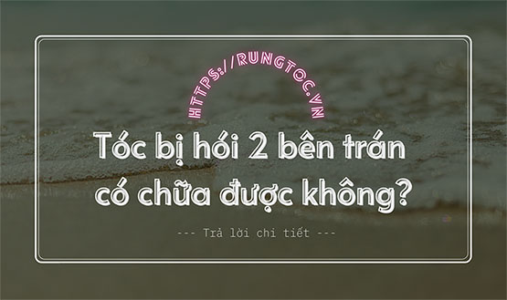 Tóc bị hói 2 bên trán có chữa được không? Giải đáp chi tiết!