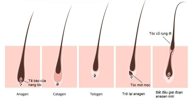 Rụng tóc Telogen là gì Dấu hiệu nguyên nhân  hướng khắc phục  Rungtocvn